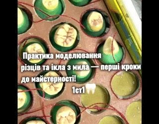 Практичне заняття з терапевтичної стоматології